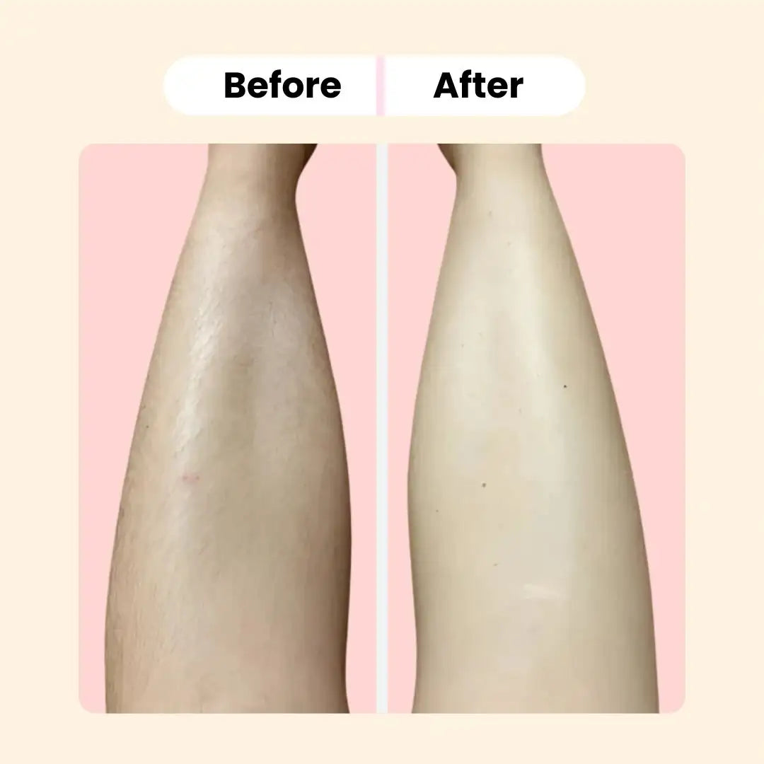 Belenora™ Lady Epilator