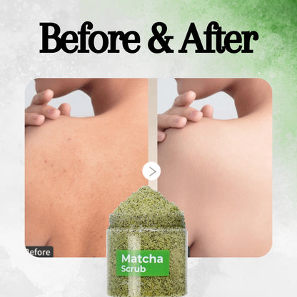 Matcha Body Scrub