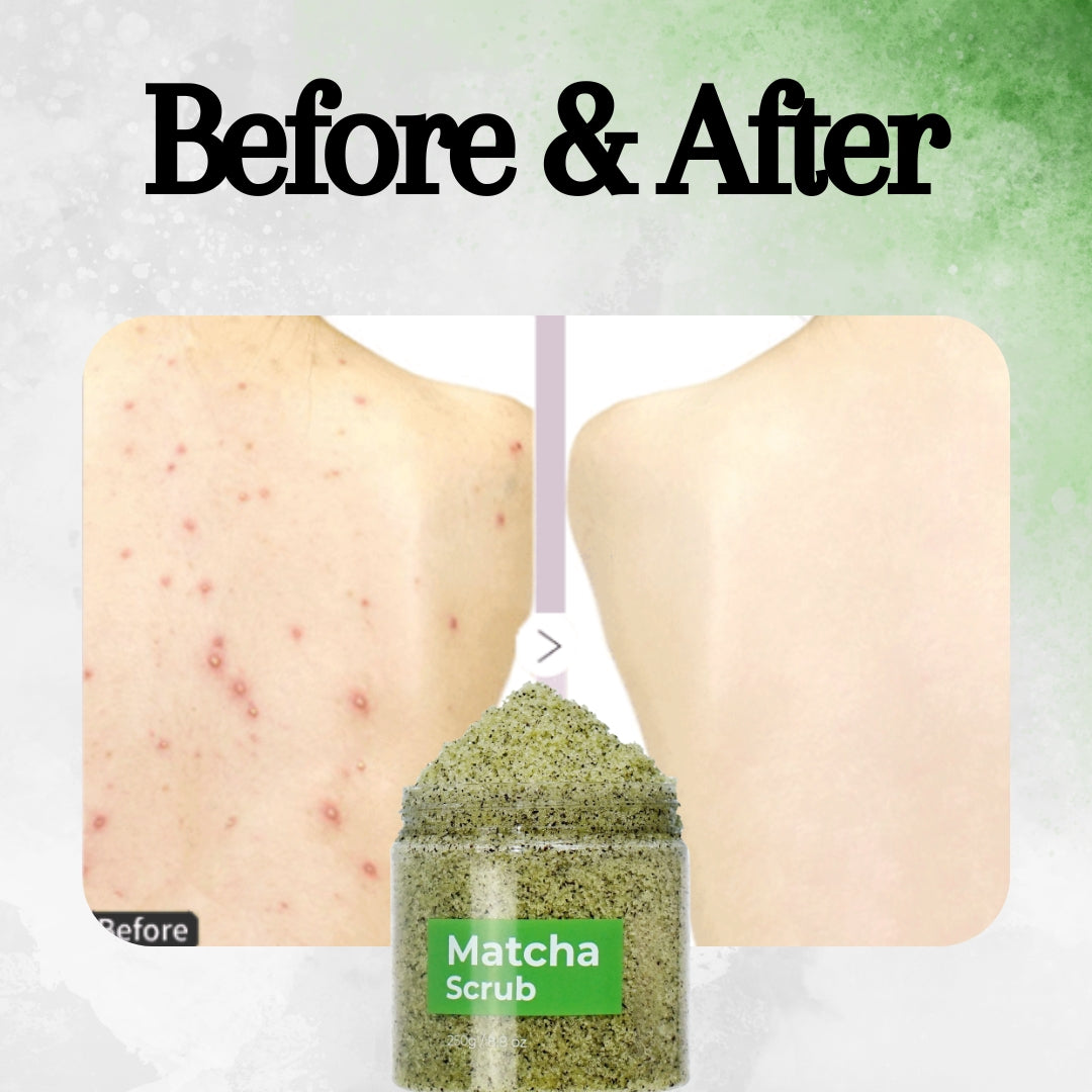 Matcha Body Scrub